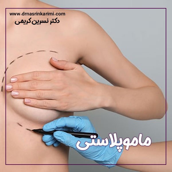 ماموپلاستی در کرمانشاه | دکتر نسرین کریمی