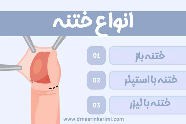 ختنه در کرمانشاه + دکتر نسرین کریمی