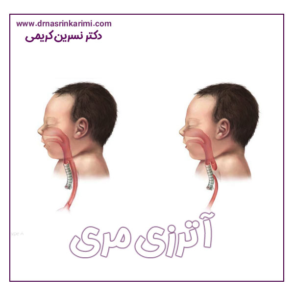 آترزی مری در کرمانشاه + دکتر نسرین کریمی