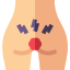 عمل هموروئید
